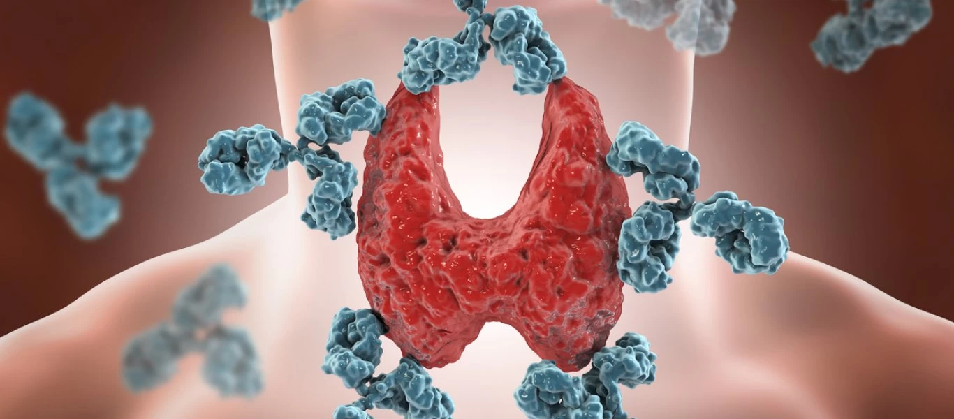 Θυρεοειδίτιδα Χασιμότο: Οι τροφές και τα συμπληρώματα διατροφής που θα σας βοηθήσουν να την αντιμετωπίσετε